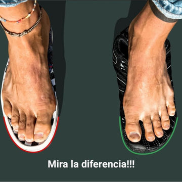 Zapatos para Juanetes: Cómo el Barefoot Reduce el Hallux Valgus